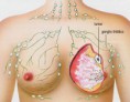 INFORMACIÓN Y DATOS SOBRE CÁNCER